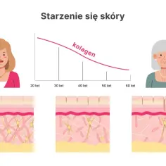 Wykres pokazuje, co daje kolagen: jego ilość spada z wiekiem, co wpływa na wygląd skóry.